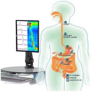 <font color=red>胃肠</font>动力学检查系统 Solar GI 