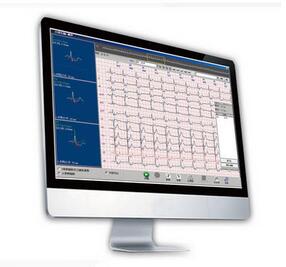 动态心电图分析系统Cardio 8000 