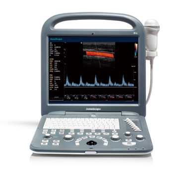 全新彩色多普勒超声诊断系统S2N