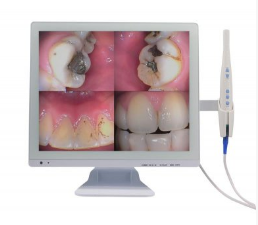 佰嘉莉口腔内窥镜+17寸医用显示屏一体机CF-989